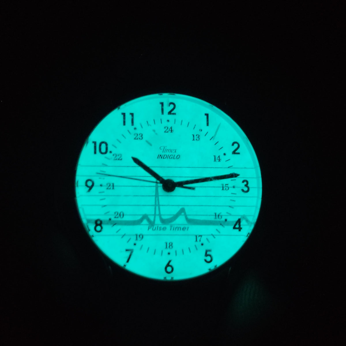 Vintage 1993 Timex Indiglo Nurse Pulse Timer 30mm Women's Quartz Watch Restored